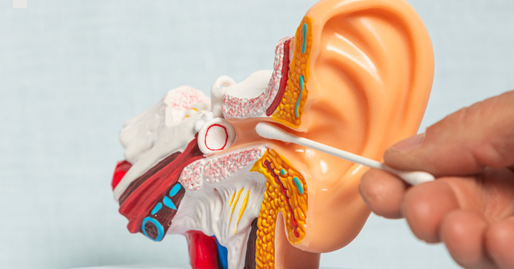 Diagram showing causes and treatment options for earwax blockage