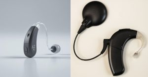 Comparison of cochlear implants and hearing aids for older adults